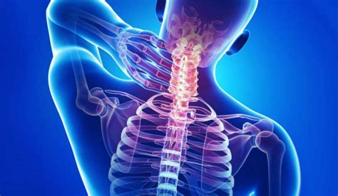 The Classic: The Cervical Syndrome 